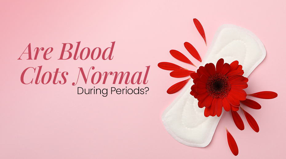 Are Blood Clots Normal During Periods?